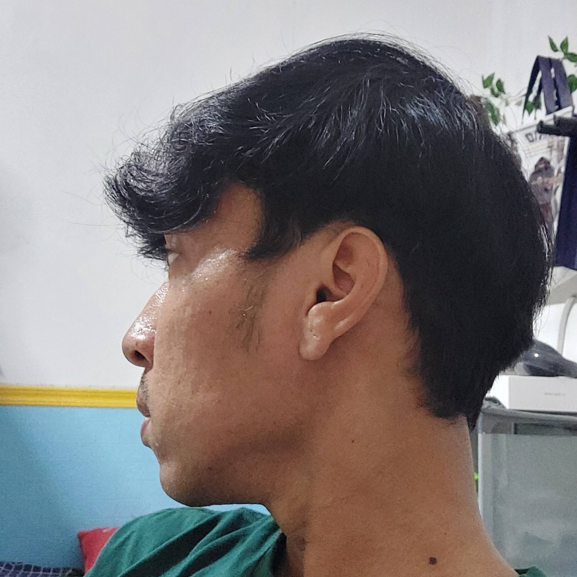 winda apriyanto