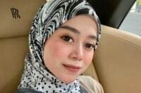 Pengacara Ungkap Kondisi Lesti Kejora Pasca Alami KDRT