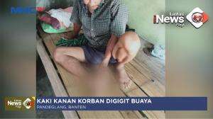 Warga Diserang Buaya