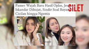 Penampilan Baru Jessica Iskandar Pasca Oplas Hidung