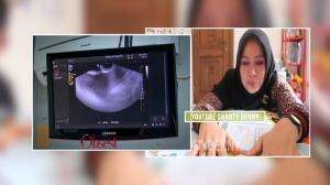 Kesedihan Shanty Denny Janinnya Tidak Berkembang