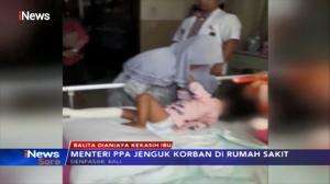 Kondisi Balita Teraniaya Kekasih Ibunya Berangsur Membaik