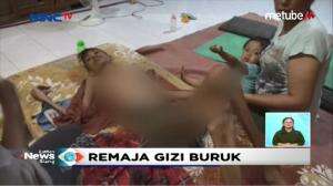 Remaja 17 Tahun Ini Menderita Gizi Buruk