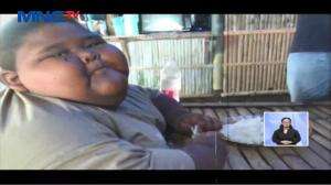 Bocah Obesitas Meninggal Dunia