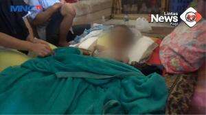 Anak Gizi Buruk dan TBC di Cianjur