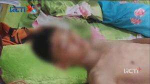 Lima Pelajar Disiram Air Keras di Jalan Raya