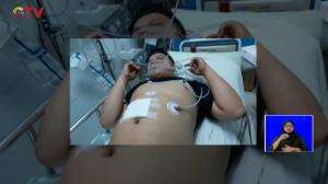 Seorang Pria Tewas Ditembak Rekan Saat Berburu