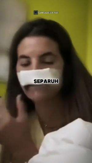 Bibir wanita ini hilang separuh! 
#wow #mengerikan #HOTrctiplus 