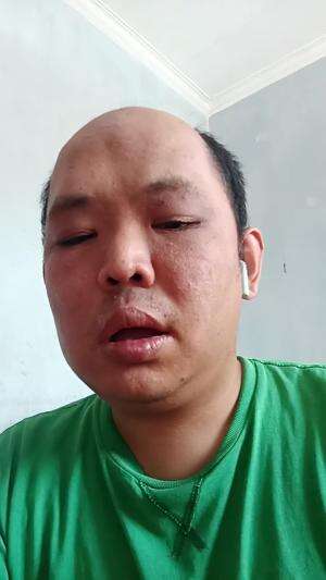 XFI2023 SOLO RENDY 35 CIMAHI APA SALAHKU D'MASIV