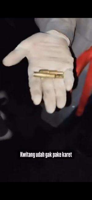 Ternyata bukan peluru karet lagi, parah nih aparat.