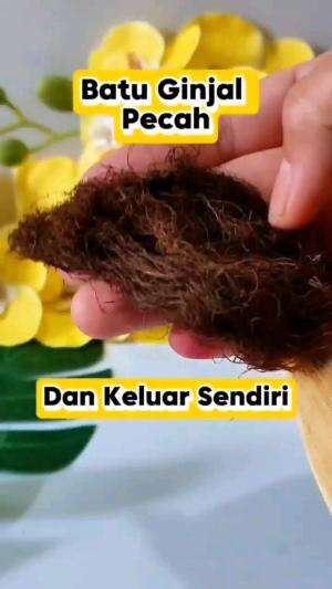 BATU GINJAL PECAH

#tipsandtrik #tips #trik #tutorial #kreatif #hiburan #inspirasi #inspiratif 