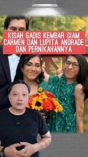 Kisah pernikahan salah satu gadis kembar Siam asal Amerika Serikat Carmen dan Lupita Andrade #Carmenlupitaandrade #kembarsiam #Amerikaserika