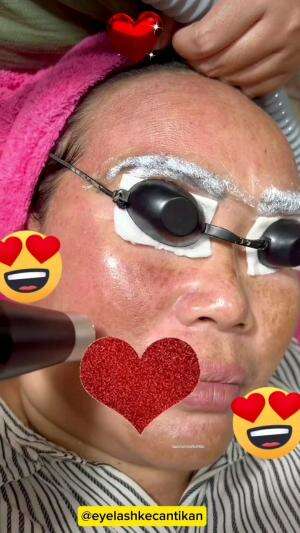 "Bunda Ini Lagi Treatment Hapus Sulam Alis Dan Treatment Picolaser Untuk Menghilangkan Flak??.#RCTIPlus #HOTrctiplus #shortplus #treatment #