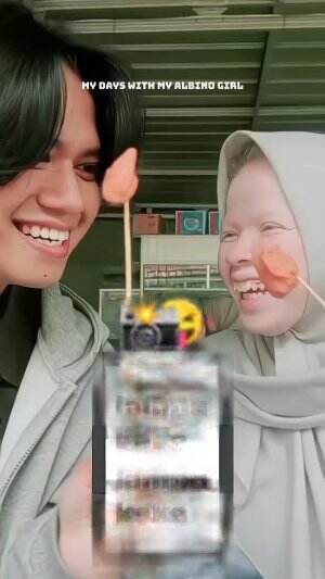 pacar albino gua nihhh #RCTIPlus #albino #fyp 