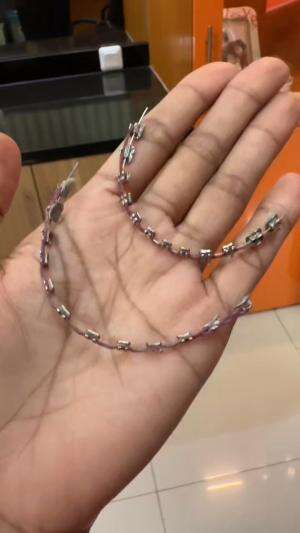 I HAVE RETAINERS CHECK