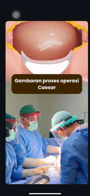 beginilah proses operasi caesar  #videoedukasi  #edukasi 