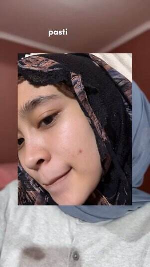 Rekomendasi serum pencerah wajah✨