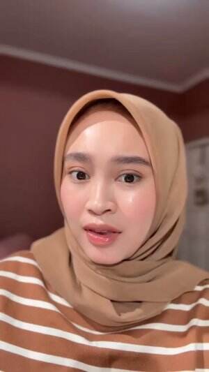 Rekomendasi Cream untuk lipatan hitam✨