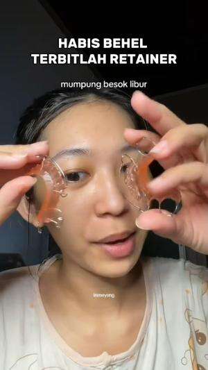 habis behel terbitlah retainer