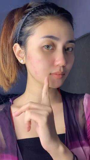 Buat acne fighter cobain produk ini siapa tau cocokkkk #youacneplus #obatjerawat #skincare #beauty #chikaaprlaa