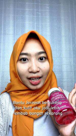 Solusi cantik luar dalam  #HOTrctiplus  #hotrcti  #pemutihbadan  #innerbeauty  #RCTIoke  