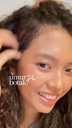 penyelamat rambut yang mulai botak ✨? #haircare #hair #curlyhair