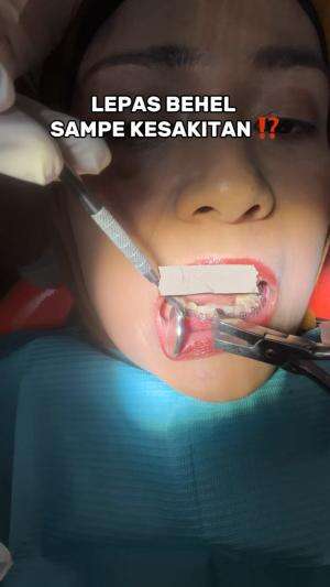 LEPAS BEHEL SAMPE KESAKITAN