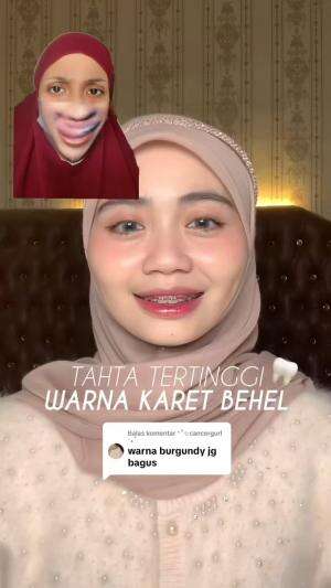 ganti karet behel sebelum lebaran