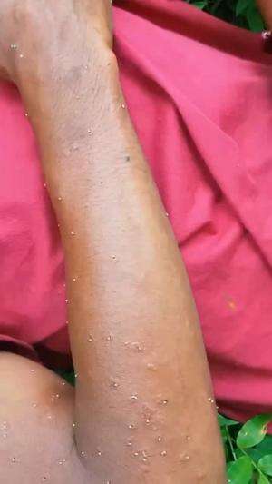 Rela disengat ratusan lebah demi setetes madu
