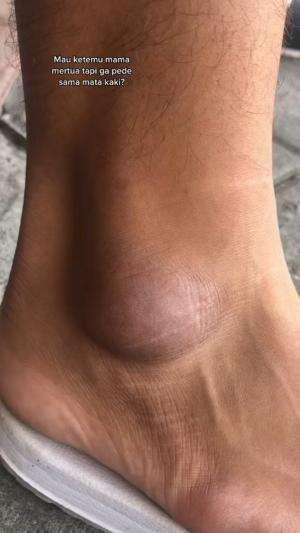akhirnya dosa2 kehitaman di mata kaki hilang 