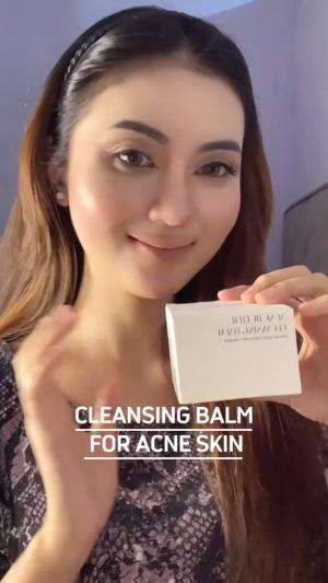 Rekomendasi cleansing balm khusus kulit berjerawat #cleansingbalm #acnefighter #beauty #chikaaprlaa