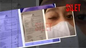 Inilah Wajah Lebam Lesti Sampai Rahang Geser