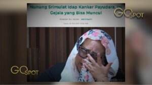 Nunung Srimulat Kena Kanker Payudara