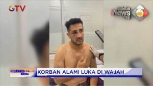 Eks Pesepakbola Claudio Martinez Dianiaya