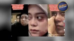 Hikmah Berharga Dibalik KDRT Yang Dialami Lesti