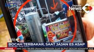 Bocah Terbakar Akibat Jajan Es Asap