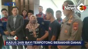 Kasus Jari Bayi Terpotong