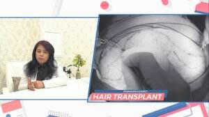 Nonton Streaming Mengatasi Masalah Kebotakan dengan Metode Transplantasi ! Online Download Full Episode Sub Indo - RCTI+