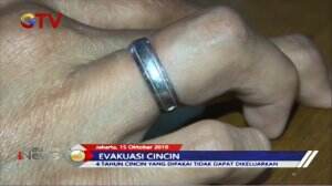 Gratis! Evakuasi Cincin Jari Manis Tidak Dipungut Biaya