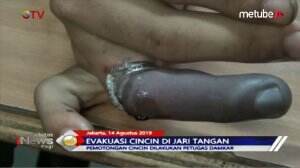 Evakuasi Cincin Di Jari Pemuda