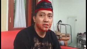 Pengakuan Teddy Perihal Tudingan Negatif Terhadapnya