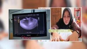 Kesedihan Shanty Denny Janinnya Tidak Berkembang