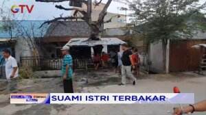 Sepasang Suami Istri Tubuhnya Terbakar Saat Hendak Menambal Ban