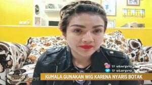 Barbie Kumalasari Nyaris Botak