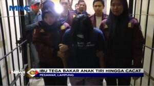 Kesal, Ibu Tega Bakar Tangan Anak Dikompor Menyala
