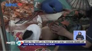 Bocah Diserang Anjing Liar