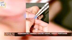 Congrats! Dinda Hauw Hamil Anak Pertama