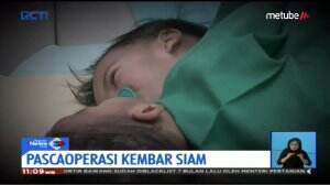 Kondisi Pascaoperasi Bayi Kembar Siam