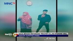 Aksi Penyandang Sindrom Treacher Collins