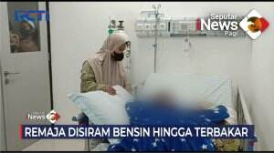 Remaja Disiram Bensin Hingga Terbakar